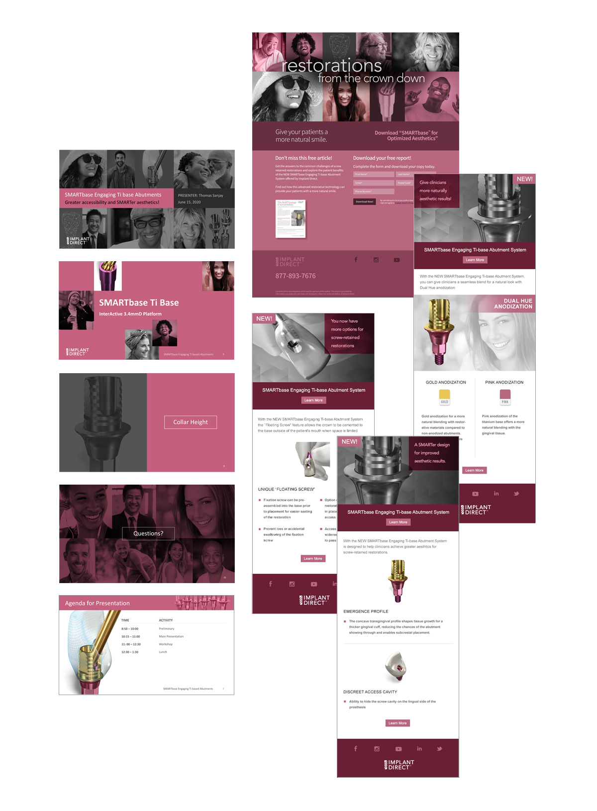 Implant Direct Lead Generation